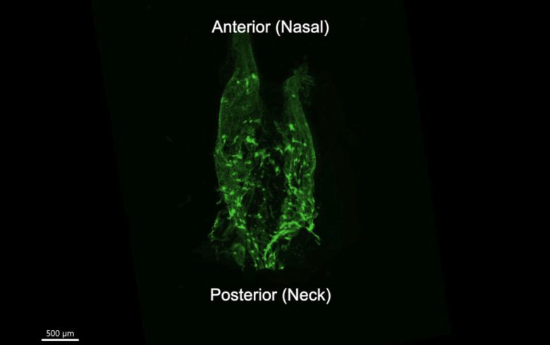 형광 표지자 발현 생쥐의 비인두 림프관망을 조직투명화 과정 후 3차원으로 재구성한 이미지.[IBS 제공]