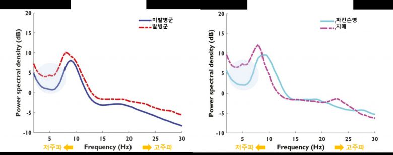 [그래프] 신경퇴행성질환 발병 여부(왼쪽) 및 신경퇴행성질환 유형(오른쪽)에 따른 뇌파 비교