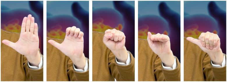 신경활주운동 사진, 5개 동작을 5초씩 번갈아가면서 해주면 된다.