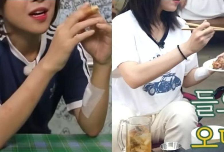 먹방 유튜버 쯔양의 과거 영상 속에서 확인된 팔의 상처들. [온라인 커뮤니티 캡처]