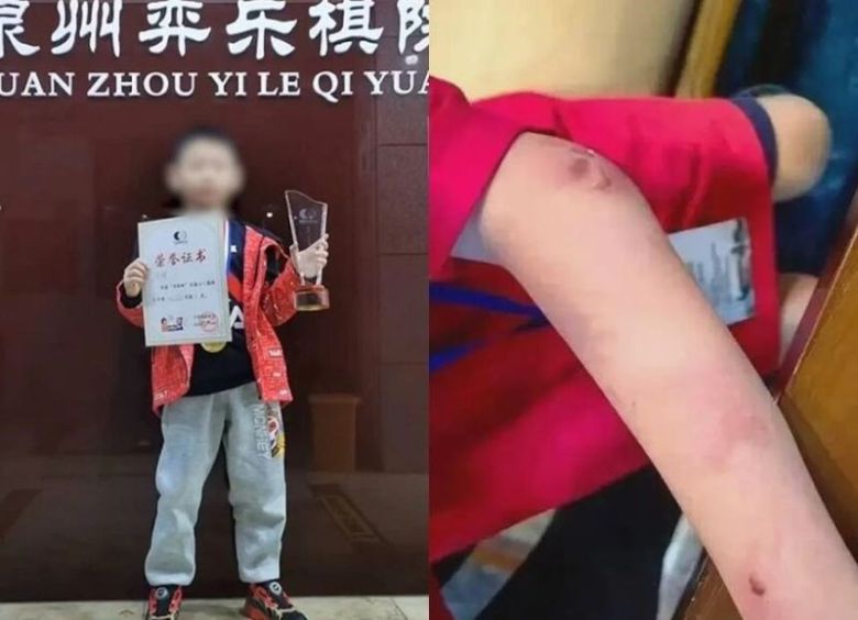 중국의 바둑 신동 주훙신이 아버지로부터 상습적으로 폭행을 당했다는 의혹이 제기됐다. [소후닷컴]