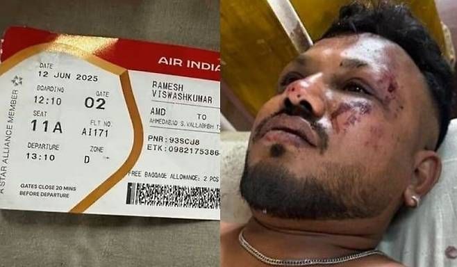 12일(현지시간) 인도 서부 구자라트주 아마다바드에 발생한 에어인디아 항공기 추락 사고의 유일한 생존자 비슈와스 쿠마르 라메시 [힌두타임스]