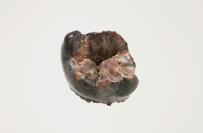 공주 왕릉원 2호분에서 출토된 어금니. [국립부여문화유산연구소]