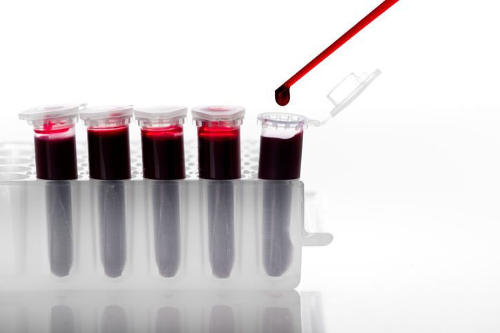 [게티이미지뱅크]