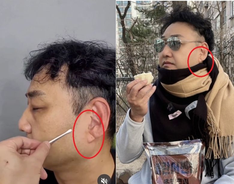 개그맨 김수용(59)이 최근 갑자기 의식을 잃고 쓰러져 병원에서 입원 치료를 받고 있는 가운데, 그의 귓볼에 있던 사선 주름이 전조증상이라는 주장이 제기됐다. [김수용 인스타그램]