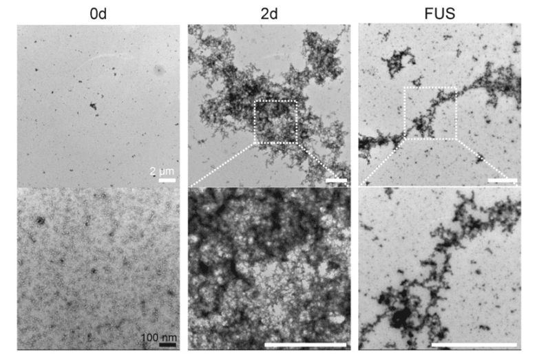전자현미경 촬영 결과, 뭉쳐있던 아밀로이드 응집체(2d)가 초음파 조사 후(FUS) 잘게 부서진 것을 확인할 수 있다.