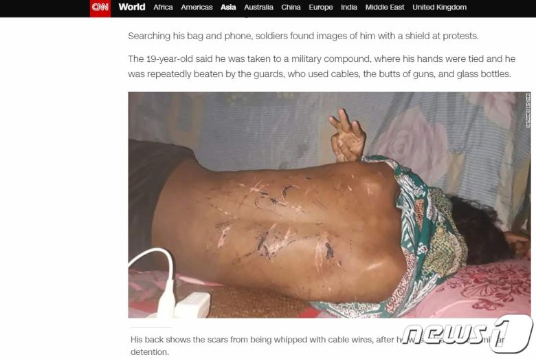 지난 4일 군부에 끌려갔다 모진 고문을 당하고 풀려난 A는 익명을 요구한 채 CNN 인터뷰에 응했다. 사진은 CNN 온라인 보도화면 갈무리.