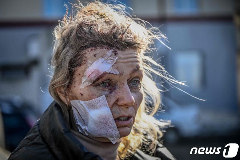 러시아군의 폭격을 맞은 우크라이나 동부 도시 추위우의 한 아파트 앞에서 얼굴에 상처를 입은 한 여성이 망연자실한 표정을 짓고 있다. © AFP=뉴스1 © News1 포토공용 기자