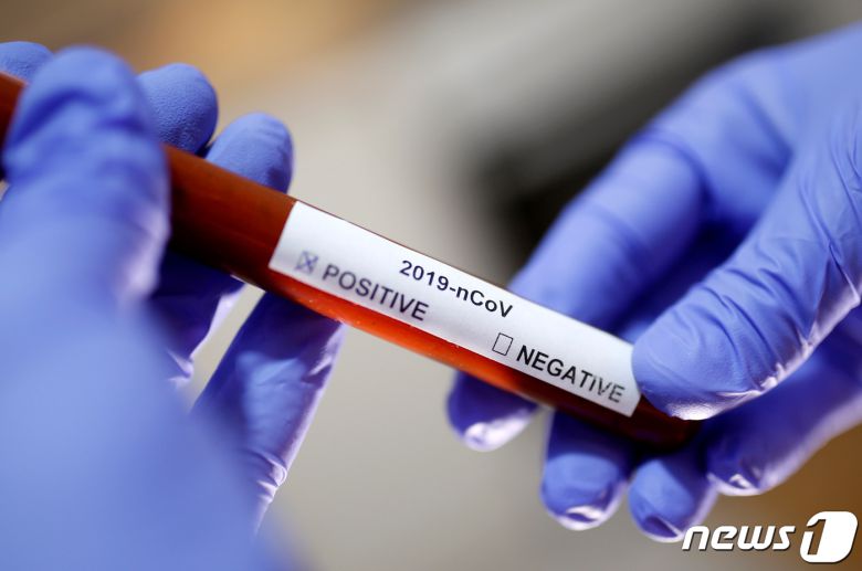 신종 코로나바이러스 감염증(코로나19) 양성 샘플. ⓒ 로이터=뉴스1 ⓒ News1 정윤영 기자