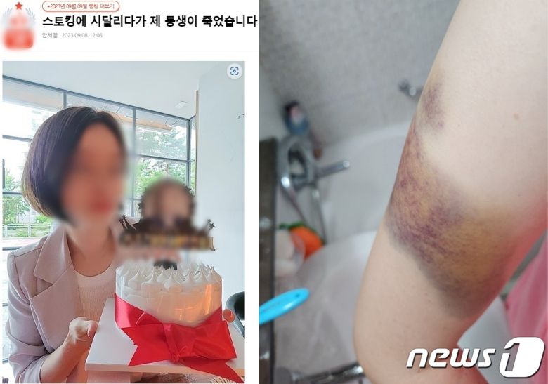 전 남자친구에게 스토킹 피해를 겪다가 스마트워치 반납 나흘만에 살해당한 피해 여성. 사진은 여성의 동생이 인터넷 커뮤니티에 가해자에 대한 엄벌을 촉구하면서 올린 여성의 사진과 가해자로부터 (언니가)폭행 피해를 당한 모습을 남긴 사진(인터넷 커뮤니티 캡처)2023.9.18/뉴스1 ⓒ News1 박아론 기자