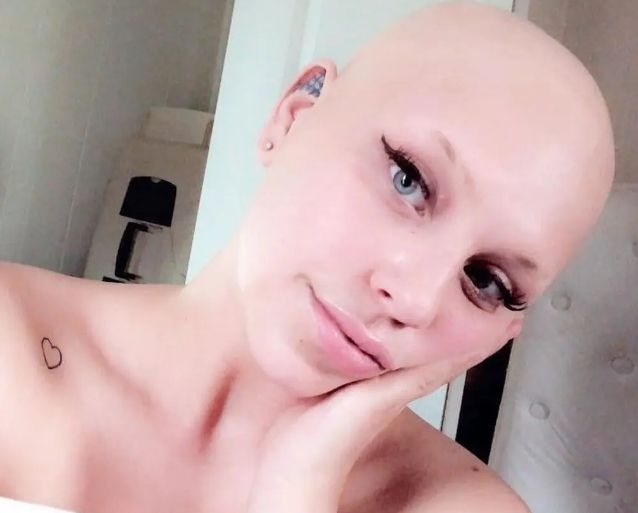 탈모로 힘들어하는 연인을 위해 4년간 기른 자신의 머리를 가발로 만들어 선물한 한 남성의 사연이 감동을 안기고 있다. 뉴욕포스트 갈무리