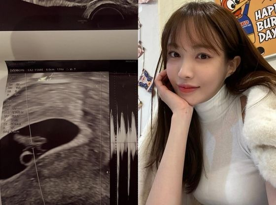 서민재 인스타그램