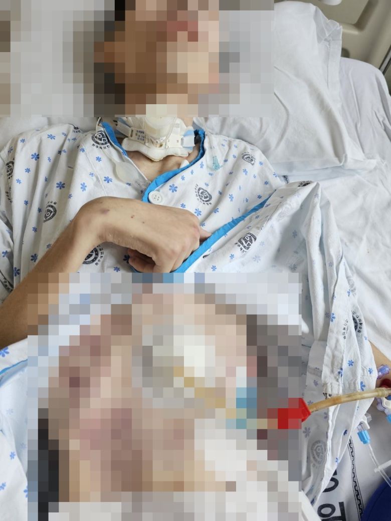 부대내 지속적인 괴롭힘으로 인해 중증 뇌 손상으로 쓰러진 뒤 2년째 식물인간 상태인 원 일병. 출처=보배드림