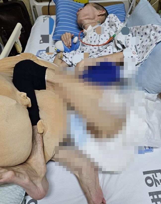 부대내 지속적인 괴롭힘으로 인해 중증 뇌 손상으로 쓰러진 뒤 2년째 식물인간 상태인 원 일병. 출처=보배드림