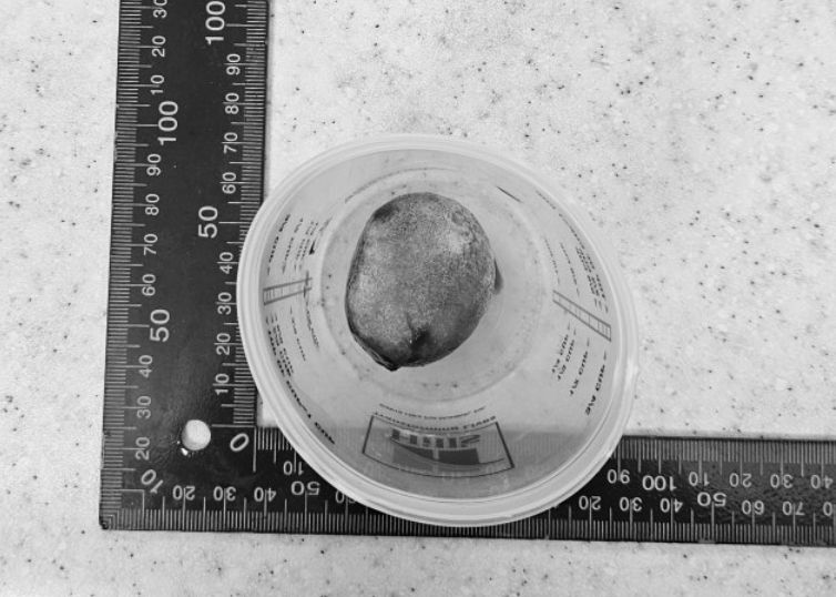 방광에서 제거한 결석(광주 스카이동물메디컬센터 제공) ⓒ 뉴스1