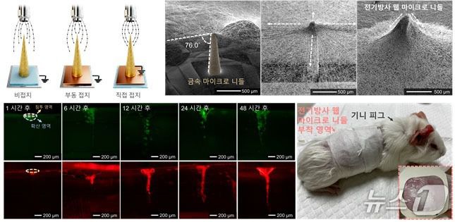 전기방사 웹 마이크로 니들의 제작 결과 및 약물 전달 결과(기계연 제공) /뉴스1