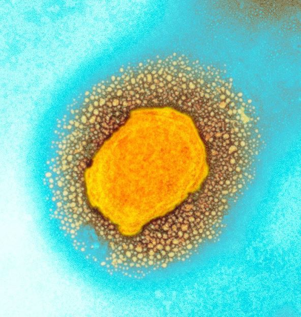 원숭이 두창을 일으키는 원숭이 마마 바이러스. [사진= 영국 보건안전청(UKHSA) 제공]