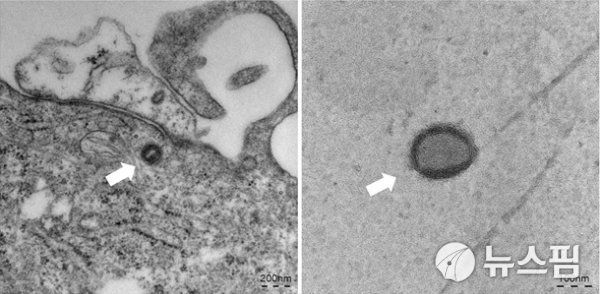 원숭이두창 바이러스 전자현미경 사진(바이러스입자 크기: 150-200nm).[자료=질병관리청] 2022.08.17 kh99@newspim.com