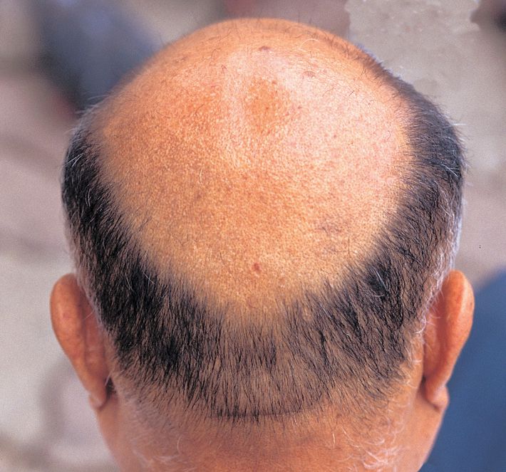 스마트이미지 제공