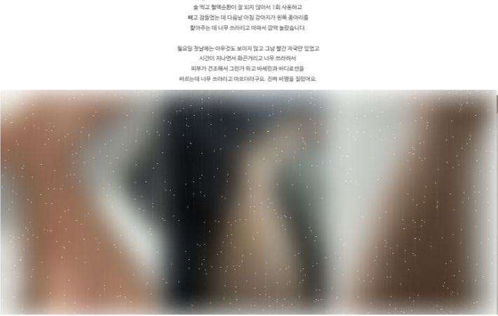 또다른 고객은 "문제의 온열 기능을 사용하지 않았음에도 저온 화상을 입었다"고 주장했다. SNS 캡처