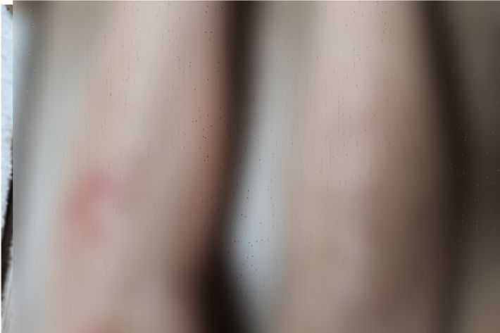 제품을 사용한 한 고객이 신체 일부 화상을 입었다고 주장했다. SNS 캡처