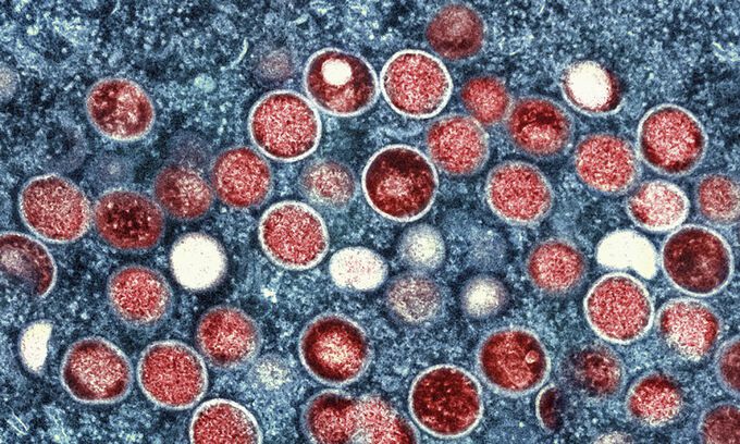 사진은 원숭이두창 바이러스 입자(붉은색) 전자현미경 이미지. 미 국립알레르기·전염병연구소(NIAID) 제공