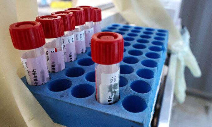 코로나19 검체통. 연합뉴스