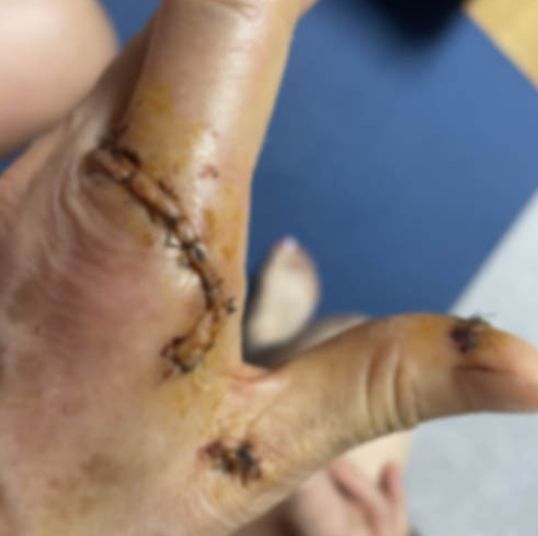 사건 당시 집 앞에서 흉기에 찔린 피해 여성이 ‘살려달라’ 외쳤고 이를 듣고 바로 뛰쳐나간 모친 역시 가해자를 말리다 칼에 다쳤다. 이상 네이트판 캡처