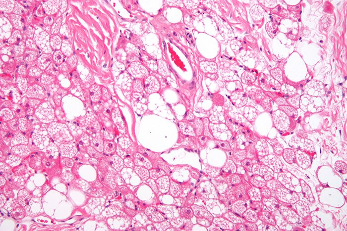 갈색지방 조직. 출처=위키피디아(https://en.wikipedia.org)
