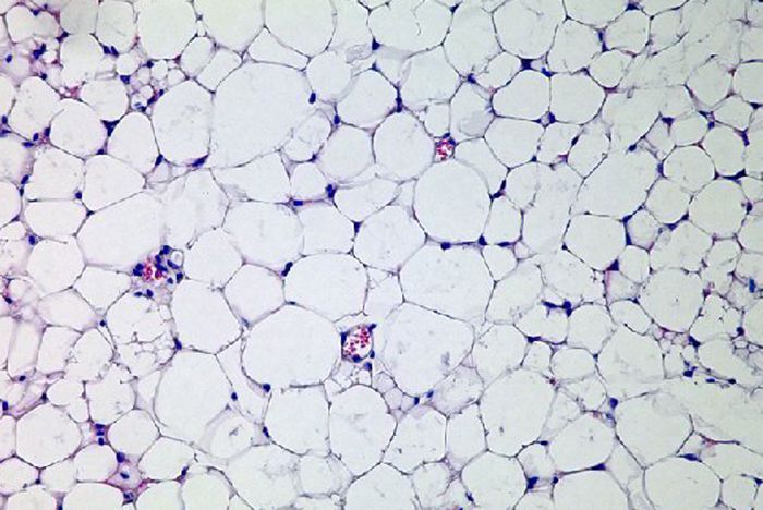 백색지방 조직. 출처=http://jameshanleybiol3500.blogspot.kr