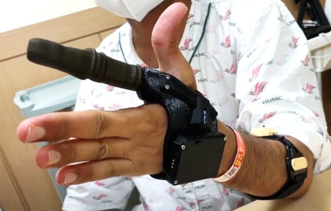 부분 손 절단 장애인이 마크 7D를 착용한 모습. 만드로 제공