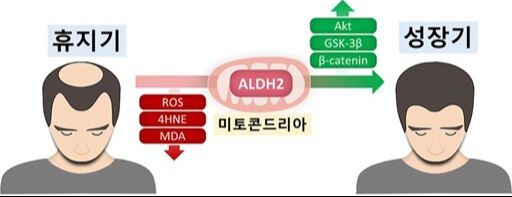 ALDH2를 활성화하면 산화 스트레스를 감소시키고, 베타카테닌을 증가시켜 모낭을 성장기로 전환할 수 있다. 서울대병원 제공