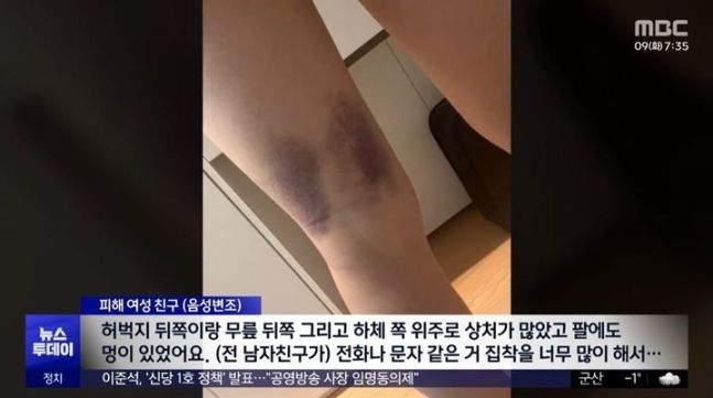 사진=MBC 방송화면 갈무리