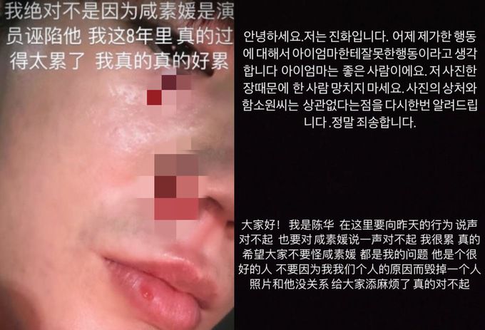 진화가 폭행 사실을 이야기한 후 번복했다. 인스타그램 캡처