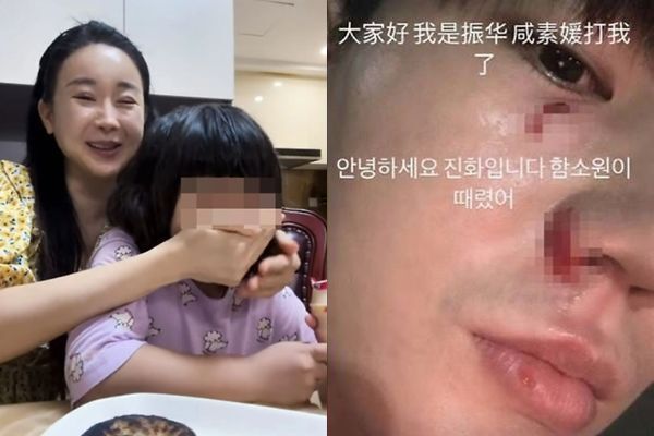 함소원이 8일 라이브 방송 도중 딸의 입을 막는 모습(왼쪽)과 진화가 지난 6일 ‘함소원이 때렸다’며 공개한 상처 난 얼굴. 함소원·진화 인스타그램 갈무리