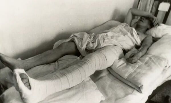 오홍근 기자가 1988년 8월6일 육군 정보사령부 요원들에 의해 자택 앞에서 흉기 피습을 당해 병원에 입원한 모습. 세계일보 자료사진