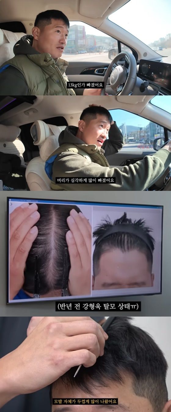 강형욱이 갑질 논란에 휘말린 후 스트레스성 탈모에 시달렸다고 고백했다. 유튜브 채널 ‘강형욱의 보듬TV’ 캡처