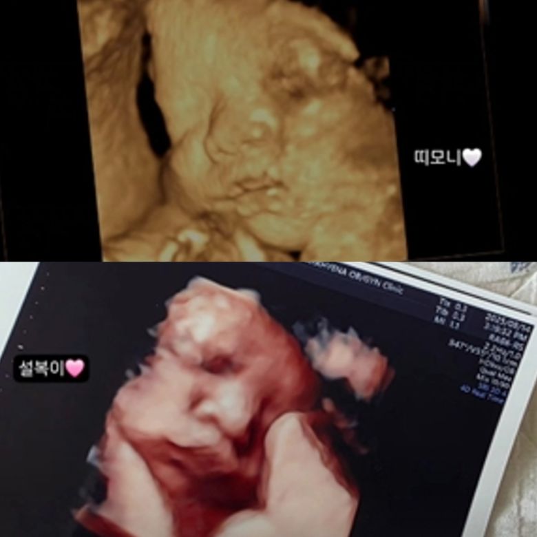 박보미의 첫째(위), 둘째 초음파 사진. 박보미 인스타그램 캡처