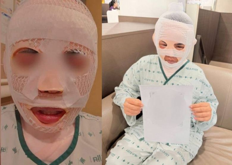 서울의 한 병원에서 치료 중인 태국 여성이 도움을 청하는 모습. 그는 잠든 사이 한국인 남편이 얼굴에 끓는 물을 부어 화상을 입었다. 사회관계망서비스(SNS) 캡처