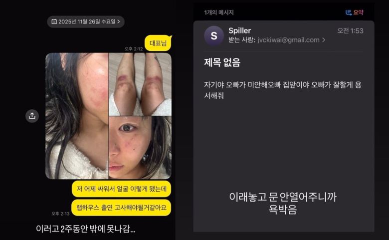 재키와이가 공개한 폭행 흔적. 재키와이 인스타그램 캡처
