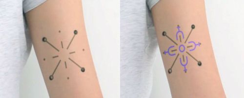 출처=DermalAbyss/Vimeo