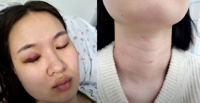 JTBC ‘사건반장’ 캡처