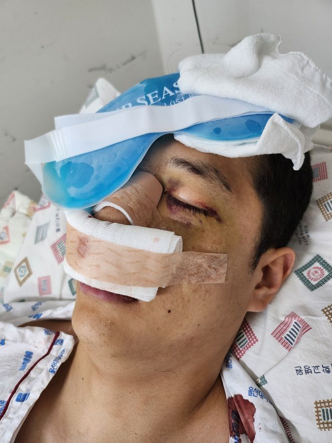 민주노총 화물연대 조합원에게 일방적으로 폭행당했다는 A씨의 모습. 본인 제공