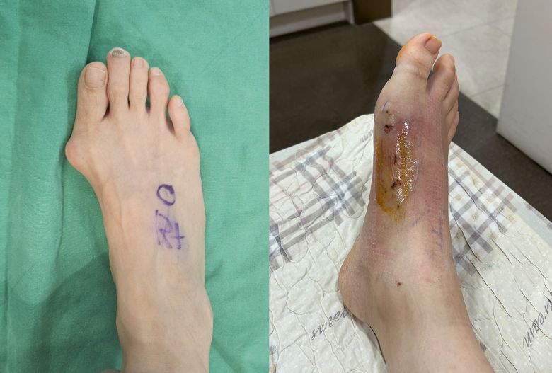 서울바른세상병원 제공