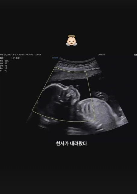 사진=훈 인스타그램