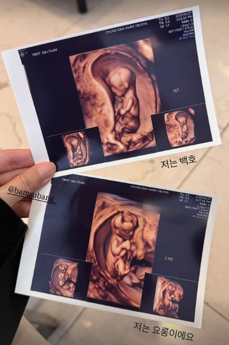 김지혜가 쌍둥이 초음파 사진을 공개하며 행복한 근황을 전했다. 김지혜 SNS 계정