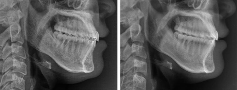 AI가 예측한 수술 후 영상(왼쪽), 수술 후 영상.