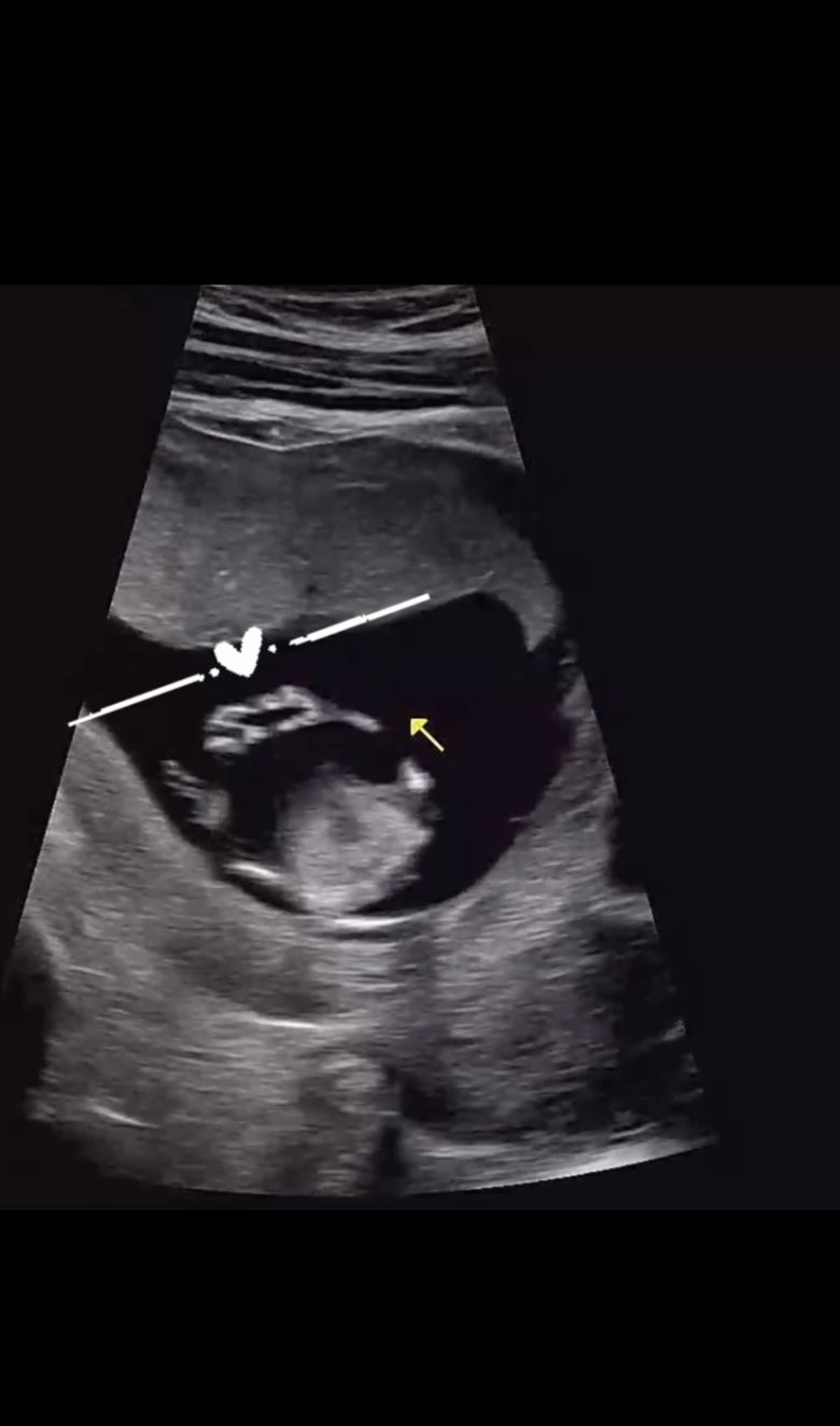 배우 박가령이 결혼 2년 만에 임신 소식을 전했다.  사진 = 박가령 SNS 계정