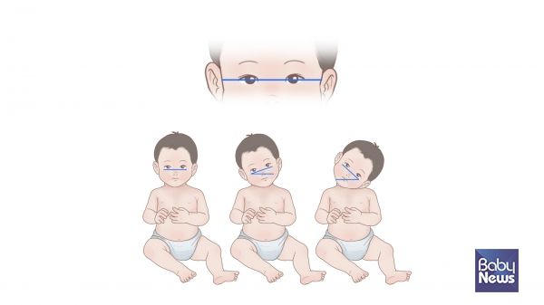 정상적인 머리와 목의 자세 및 기울기 측정법. ⓒ임신영