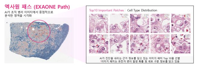 엑사원 패스는 전체 슬라이드 이미지(WSI)에서 암과 관련된 유전자 변이를 예측할 수 있다./LG